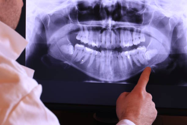 Best Holiday Emergency Dentist in Concord, MO